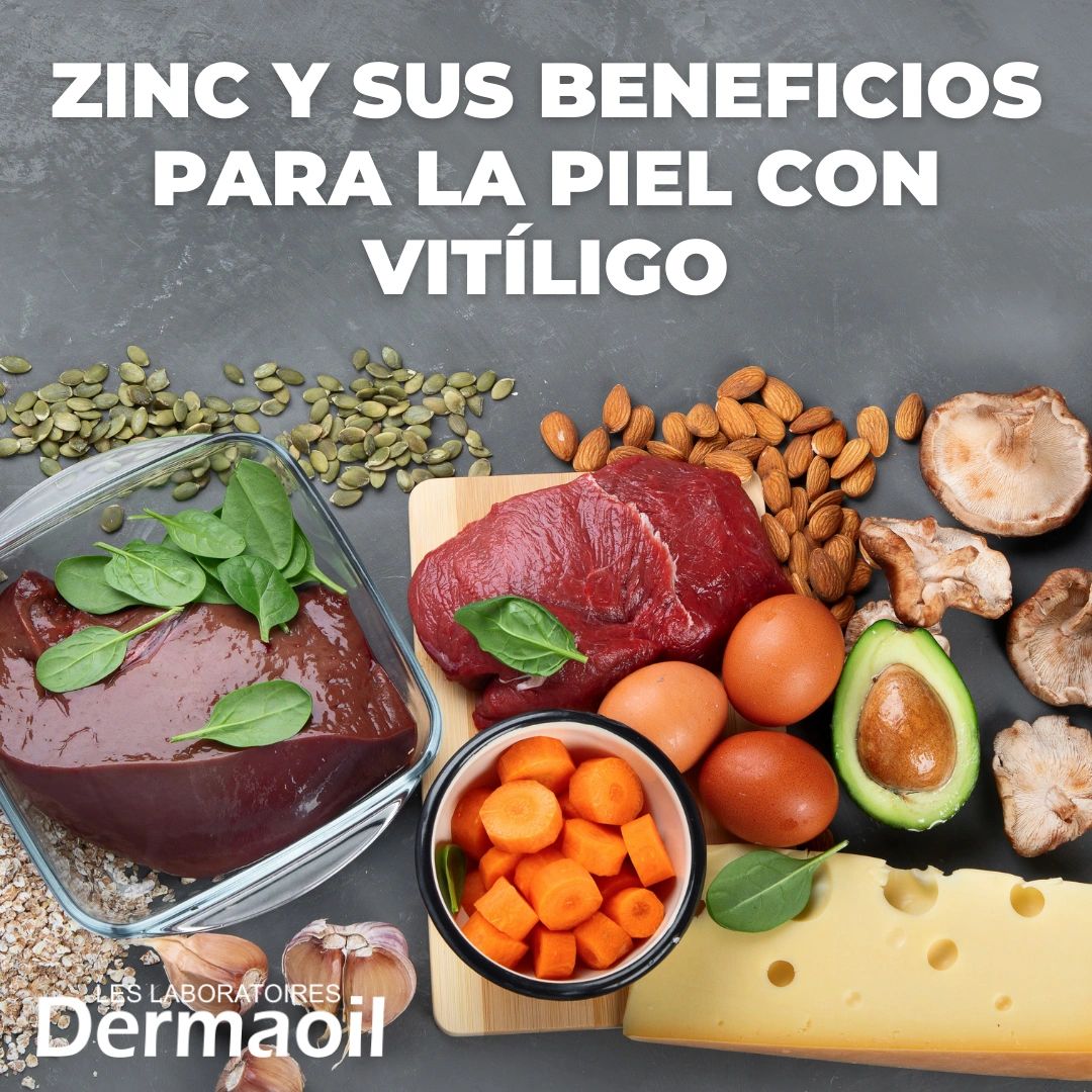 ZINC Y SUS BENEFICIOS PARA LA PIEL CON VITÍLIGO